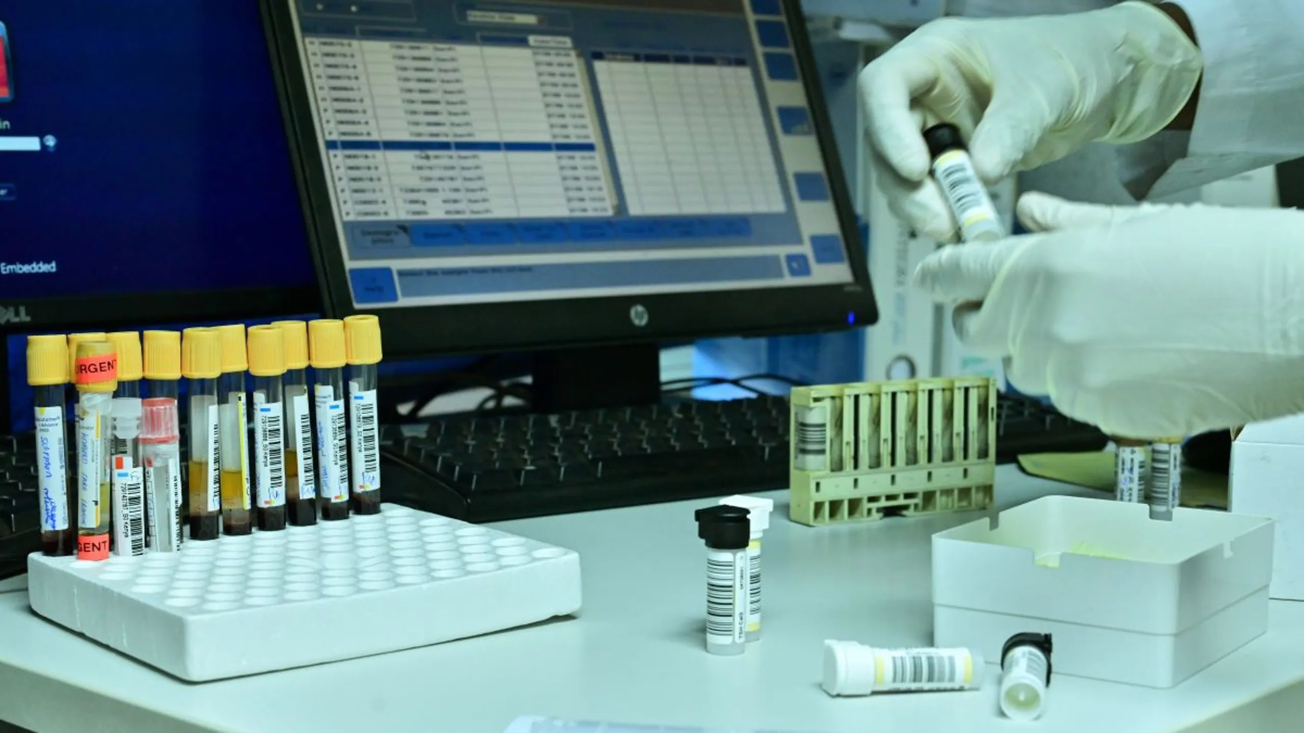 Clean The Lab Inside The Games • The week in doping: UKAD reports rise as WADA ...